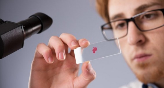 Ամերիկացի կենսաբանները ՄԻԱՎ-ը ոչնչացնող իմունային բջիջներ են ստեղծել