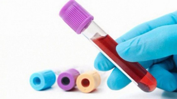 Կալիֆորնիայում արտակարգ իրավիճակ է հայտարարվել