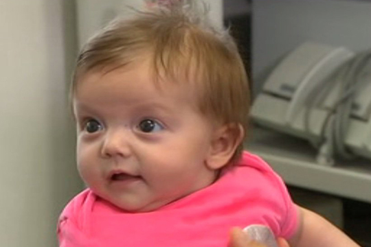 Ավստրալիայում 3D տպիչով տպված գանգը փրկել է նորածին աղջկա կյանքը