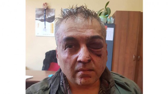Полиция Армении представила подробности разбойного нападения на банк в Ереване: нападавший обезврежен