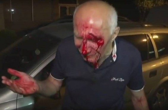 Ուղիղ միացում Խորենացի փողոցից