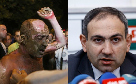 Փաշինյանն այցելել է ինքնահրկիզված քաղաքացուն