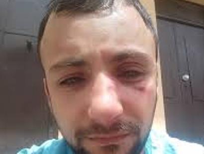 ՀԱԿ ակտիվիստ Վարդան Հարությունյանին ծեծի ենթարկելու գործը կարճվել է