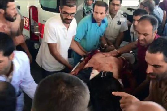 Թուրքիայի արևելքում պայթյունի հետևանքով վիրավորների թիվը հասել է 170-ի