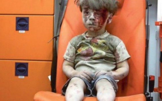 Սիրիայում մահացել է «սիրիական պատերազմի խորհրդանիշ համարվող» տղայի եղբայրը