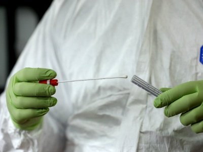 Уже 1473: В Армении зарегистрировано 72 новых случая заражения коронавирусом
