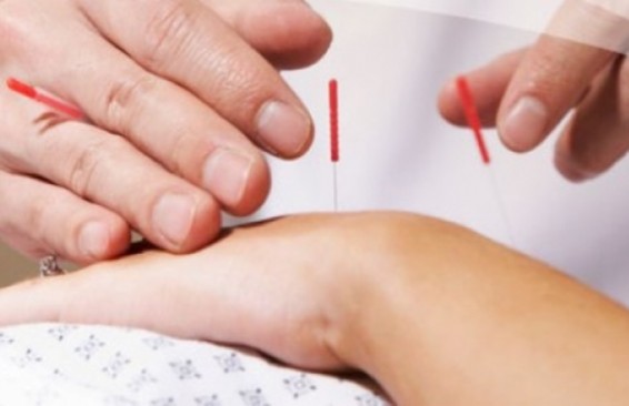 Ասեղնածակումը հոդացավերի բուժման ամենաարդյունավետ մեթոդն է