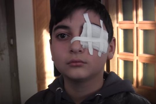 Սևանում ուսուցչուհին աշակերտի աչքը կախիչի կեռիկով հանելու համար ընդամենը 200 հազար դրամ տուգանք կվճարի՝ որպես պատիժ