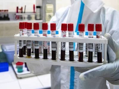 Коронавирус в Армении: число смертей перевалило за 900