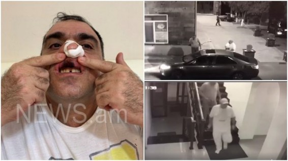 По факту инцидента в одном из офисов бизнесмена Хачатура Сукиасяна возбуждено уголовное дело