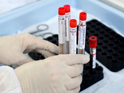 Минздрав Армении вновь сообщает о росте темпов распространения коронавируса
