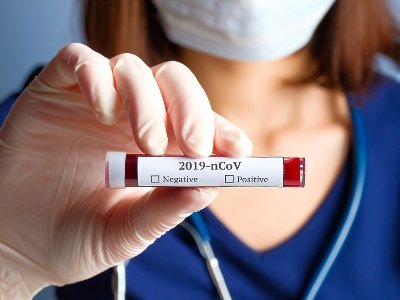 Плюс 114: число выявленных случаев заражения COVID-19 в Армении выросло до 157 948