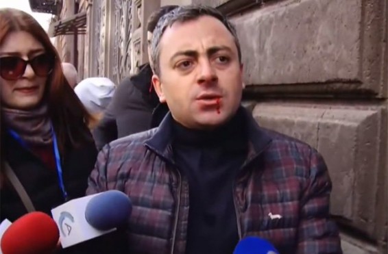 Հատուկ դիտավորությամբ բռնության է ենթարկել ՀՓՇ համակարգող Իշխան Սաղաթելյանը․ հայտարարություն