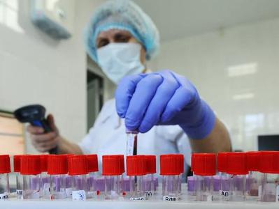 В Армении за сутки зарегистрировано уже 1029 новых случаев заражения коронавирусом