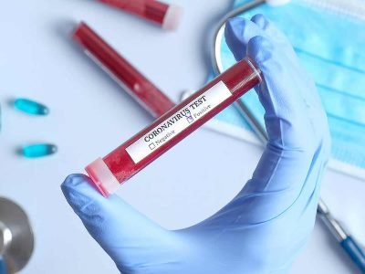 В Армении за сутки зарегистрировано 870 новых случаев заражения коронавирусом