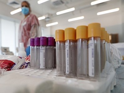 Коронавирус в Армении: число смертей перевалило за 5200