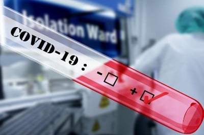 В Армении за сутки зарегистрировано 93 новых случая заражения коронавирусом