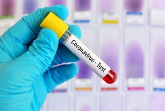 В Арцахе подтверждено два новых случая COVID-19