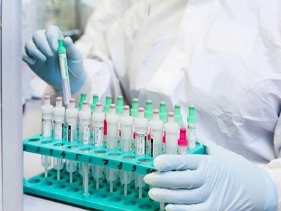 В Армении за сутки зарегистрировано 264 новых случая заражения коронавирусом