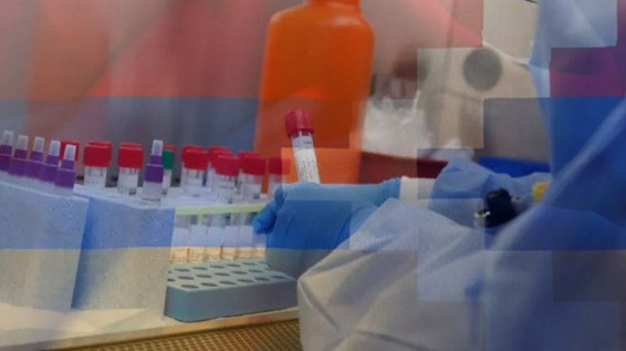 В Арцахе за минувшие сутки случаев заражения коронавирусом не выявлено