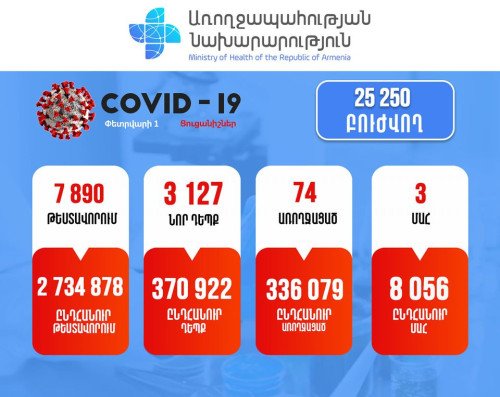 Հայաստանում հաստատվել է կորոնավիրուսով վարակվելու 3127 նոր դեպք. Մահացել է 5 քաղաքացի