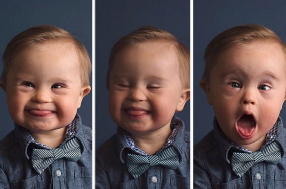 Դաունի համախտանիշով երեխային չեն ընդունել գովազդում նկարահանվելու համար, սակայն նրա մայրը չի հանձնվել