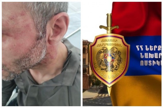 ՆԳՆ-ից արձագանքել են քաղաքացուն ոստիկանությունում ծեծելու և բերանը կպչուն ժապավենով փակելու մասին ահազանին