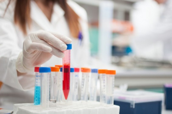 Իսպանացի բժիշկները ՄԻԱՎ-ի՝ սեռական ճանապարհով փոխանցումը կանխարգելող դեղամիջոց են ստեղծել