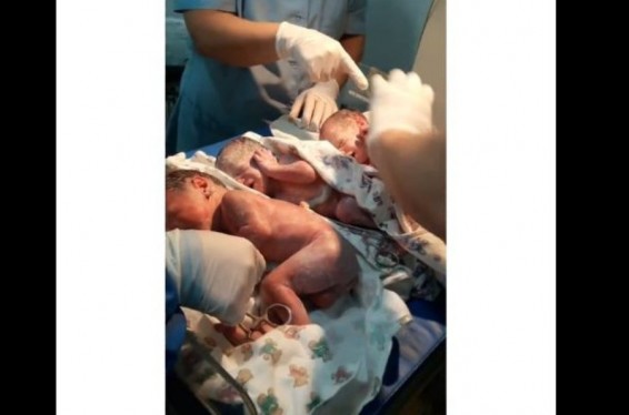 Երևանում 29-ամյա կինը եռյակ է լույս աշխարհ բերել