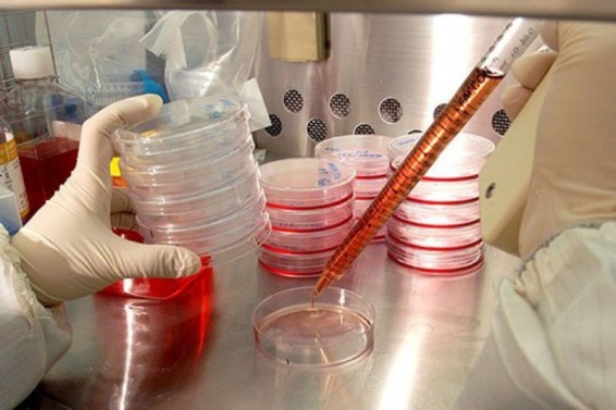 Գիտնականները պարզել են քաղցկեղով հիվանդների մոտ մետաստազի առաջացման մեխանիզմը