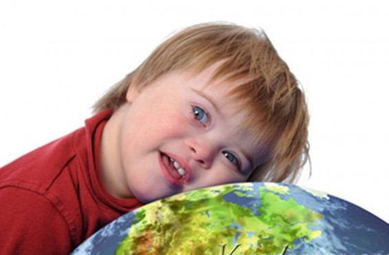 Ամեն տարի աշխարհում ծնվում է Դաունի համախտանիշով 3000-5000 երեխա. ԱՆ