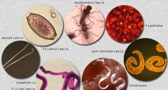 ԱՀԿ. Մոռացված արեւադարձային հիվանդությունները նահանջում են