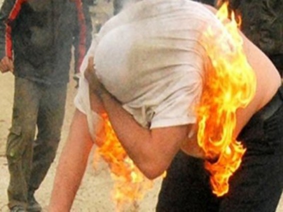 Բաքվի կենտրոնում երիտասարդ տղամարդը փորձել է ինքնահրկիզվել