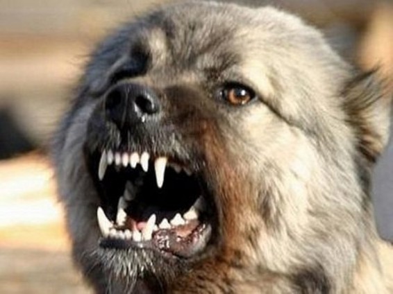 Բաքվում շունը պոկել է երեքամյա աղջնակի ականջը