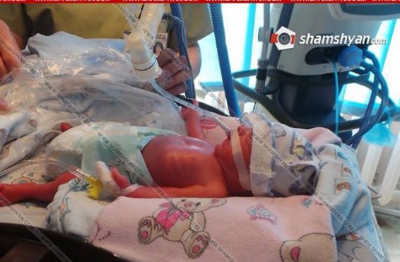 «Փոքրիկներից մեկին կայուն վիճակի ենք բերել, բայց դա դեռ չի նշանակում առողջացում». Դալլաքյան. Sputnik Արմենիա