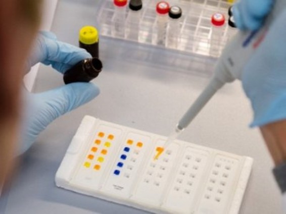 Բրազիլիայի իշխանությունները չեղարկել են Զիկայի հետ կապված արտակարգ դրության ռեժիմը