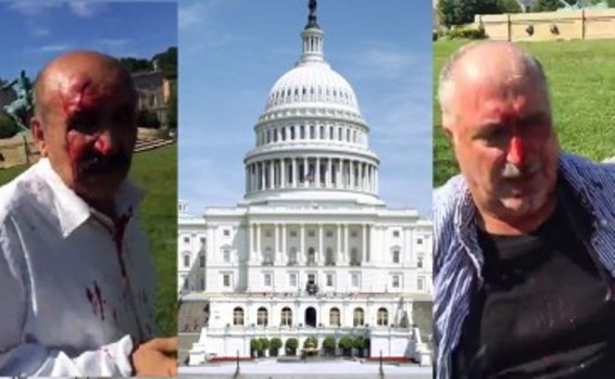 Video. ԱՄՆ-ի Կոնգրեսը պաշտոնապես դատապարտեց Էրդողանի թիկնապահների գործողությունները