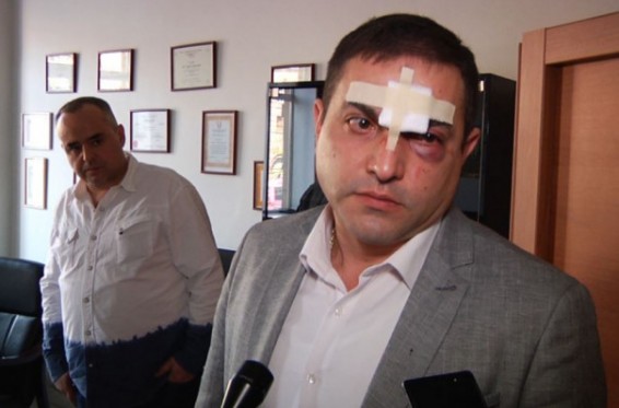 Այդ կերպ մեզ ստիպում են գնալ հաշտության, բայց մեր արժանապատվությունն ավելի բարձր է. հարձակման ենթարկված փաստաբանը կասկածյալ է ընդգրկվել քրգործում