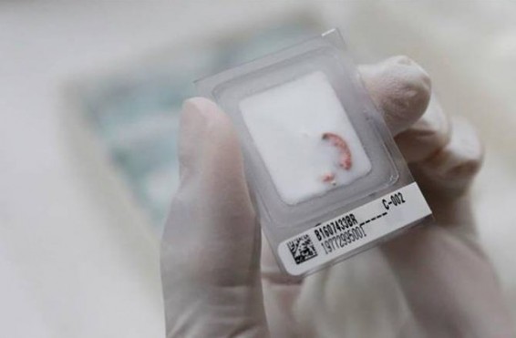 Գիտնականները քաղցկեղի վաղ հայտնաբերման արդյունավետ եղանակ են գտել