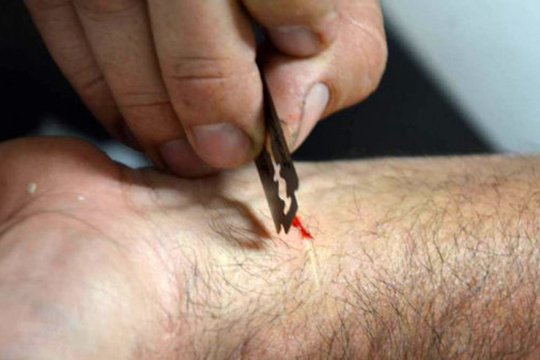 Արտառոց դեպք Գեղարքունիքում. 57-ամյա տղամարդը նախ տունն է հրկիզել, հետո՝ փորձել ինքնասպան լինել