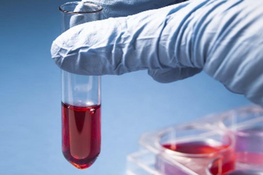 Նկատվում է սուր արտաընդերային վիրուսային հեպատիտի դեպքերի նվազում